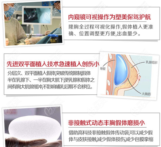 東莞西妃蘇順清隆胸手術(shù)優(yōu)勢 東莞西妃蘇順清隆胸手術(shù)優(yōu)勢