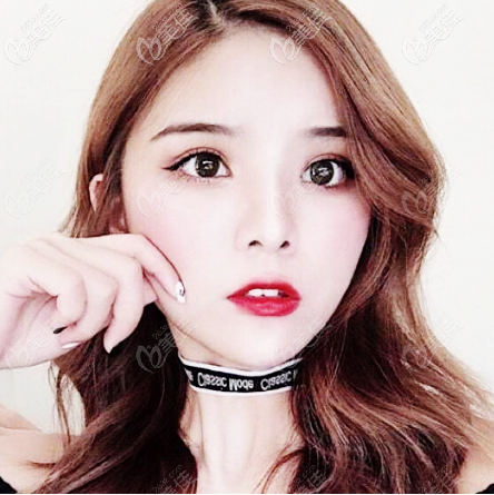 深圳鵬程醫(yī)院哪個(gè)醫(yī)生做雙眼皮好 深圳鵬程醫(yī)院哪個(gè)醫(yī)生做雙眼皮好