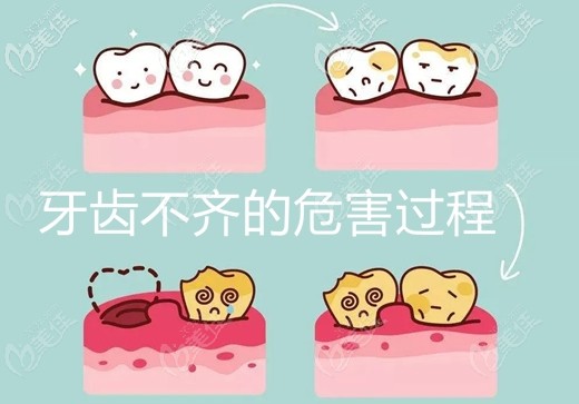 陳明社醫(yī)生淺談牙齒矯正的好處