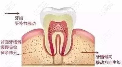 牙齒矯正有年齡限制嗎