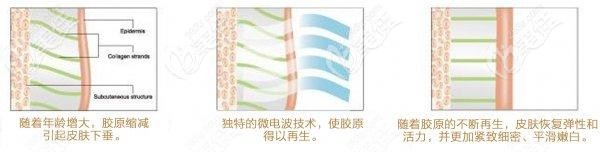 深藍(lán)射頻作用層次 深藍(lán)射頻作用層次