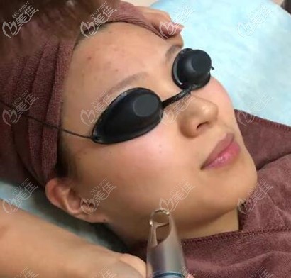 皮秒祛黃祛痘印過(guò)程 皮秒祛黃祛痘印過(guò)程