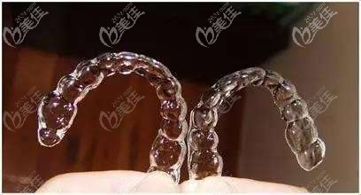 摘掉牙套就要開始佩戴保持器啦