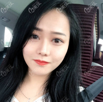 要不是廣州軍美醫(yī)生技術好我的雙眼皮也不會這么好看哦