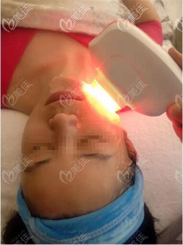 復(fù)合彩光嫩膚治療中 復(fù)合彩光嫩膚治療中