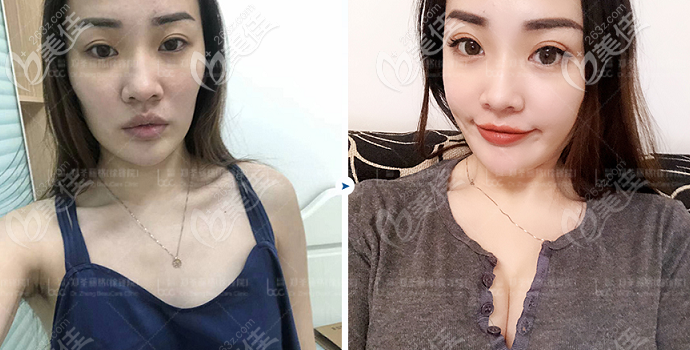 重慶鄭荃麗格3T機(jī)器人怎么樣