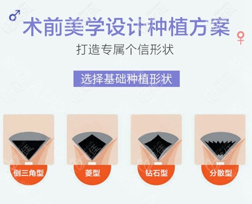 私密種植的種植形狀 私密種植的種植形狀