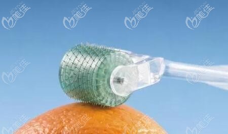 微針治療皮膚黑頭的原理 微針治療皮膚黑頭的原理