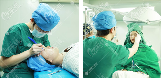 廣州曙光楊曉英醫(yī)生雙眼皮技術(shù)很厲害