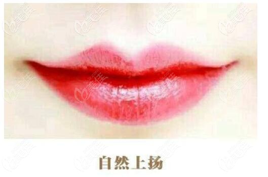 微笑唇效果圖片 微笑唇效果圖片