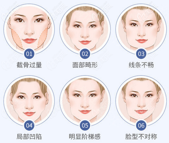 不同類型的頜面修復(fù)手術(shù) 不同類型的頜面修復(fù)手術(shù)