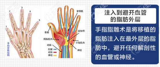 手背脂肪填充該去哪里做 手背脂肪填充該去哪里做