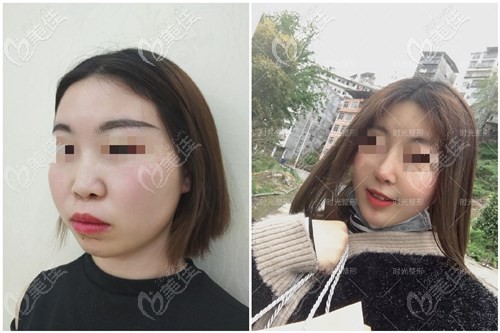 重慶時光整形醫(yī)院案例