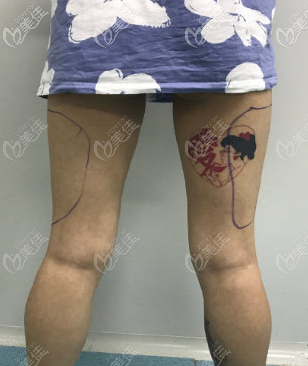 從后面看腿更粗 從后面看腿更粗