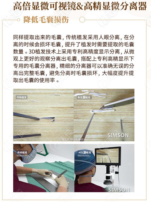 高倍顯微鏡下毛囊分離更完整