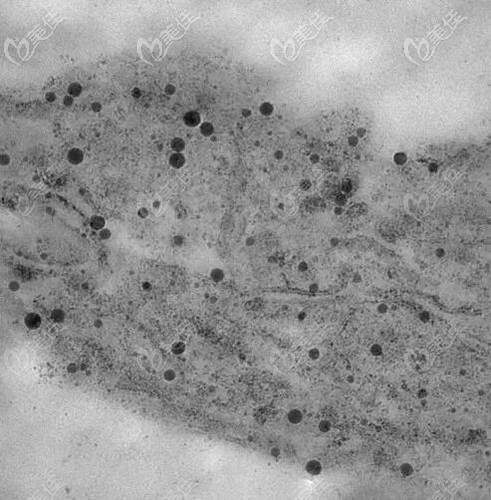 被打碎的色素顆粒 被打碎的色素顆粒