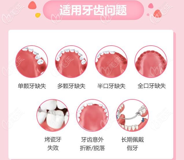 廣州穗江口腔種植牙適應(yīng)癥