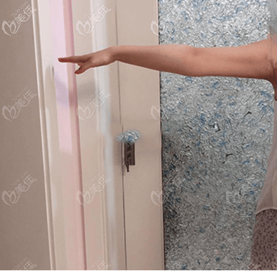 找北京雅靚陳林葉做的手臂吸脂真實案例你覺得怎么樣