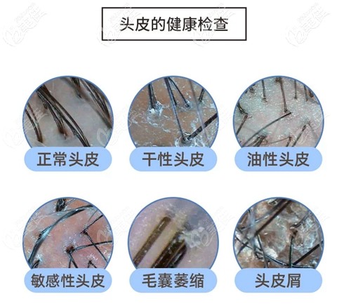 碧蓮盛專業(yè)毛囊檢測(cè)設(shè)備