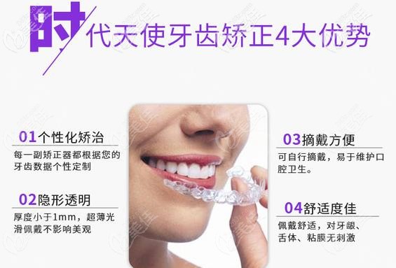 時(shí)代天使comfos優(yōu)勢(shì)