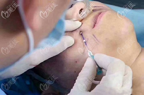 爆炸線填充效果圖