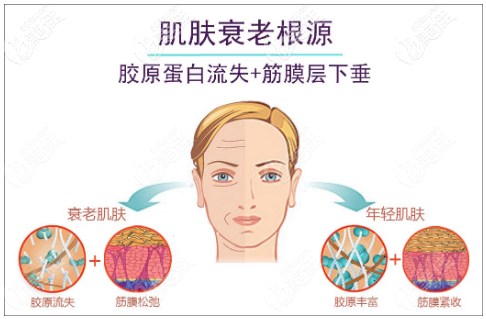 熱瑪吉治療過程 熱瑪吉治療過程