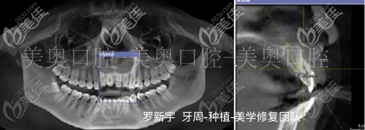 我的術(shù)前片子 我的術(shù)前片子