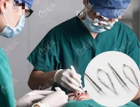 武漢涵美馮曉玲院長雙眼皮手術(shù)過程中