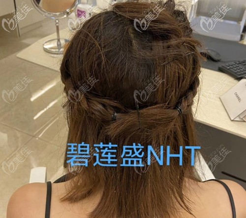 女士頭頂加密后枕部不剃發(fā)效果圖