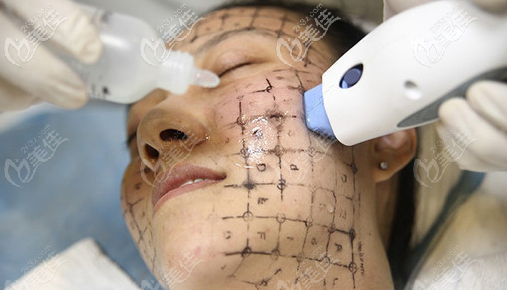 體驗(yàn)面部熱瑪吉