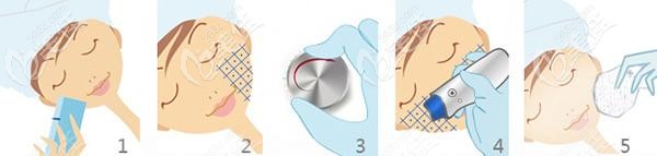 熱瑪吉的治療過程 熱瑪吉的治療過程