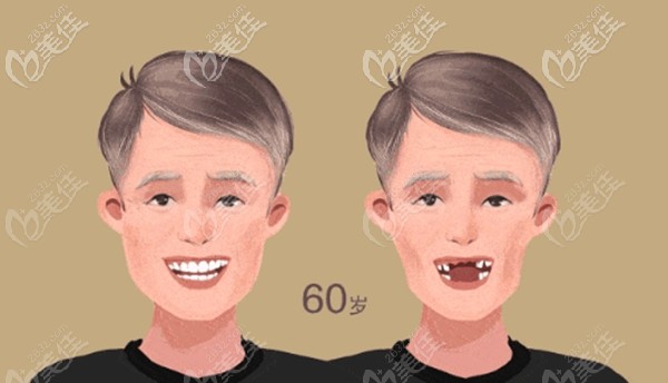 在北京中諾第二口腔醫(yī)院的種牙感受 在北京中諾第二口腔醫(yī)院的種牙感受