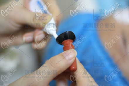 眼盾植入前步驟 眼盾植入前步驟