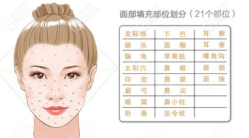 全臉脂肪填充部位劃分 全臉脂肪填充部位劃分