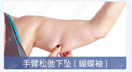 熱瑪吉蝴蝶袖緊致去皺價(jià)格在29800元左右 熱瑪吉蝴蝶袖緊致去皺價(jià)格在29800元左右