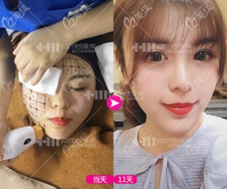 進行熱瑪吉體驗過程中