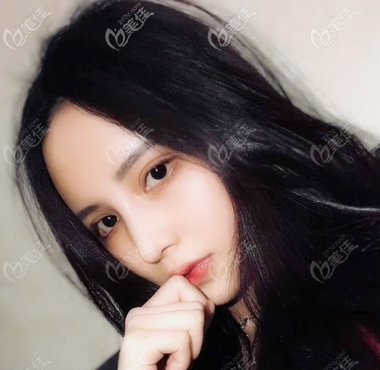 看了那么多鼻整形案例,只有廣州韓妃阿芙洛美鼻讓我心動