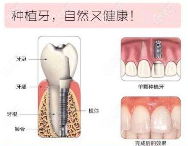 網(wǎng)上找的圖，因?yàn)橹搀w是在無菌環(huán)境下密封保存