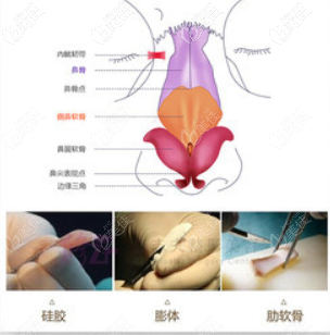 成都素美軟糖鼻優(yōu)勢