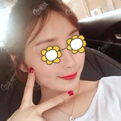 黃金微雕多久后可以做熱瑪吉？剛好太原華美有真實案例，讓顧客自己來講講吧