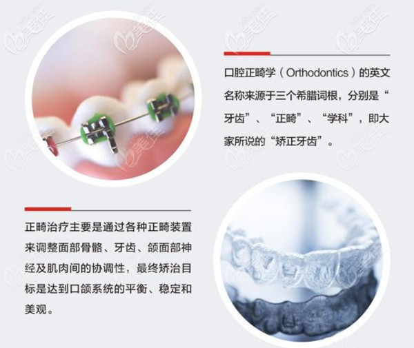 海口微笑口腔牙齒矯正優(yōu)勢