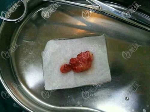 取出的生長(zhǎng)因子