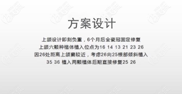 上半口ALL-ON-6即刻負(fù)重種植牙方案