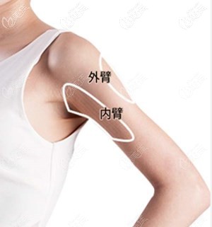 手臂吸脂圖解 手臂吸脂圖解