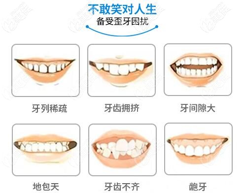 武漢虎泉口腔牙齒矯正適應(yīng)癥