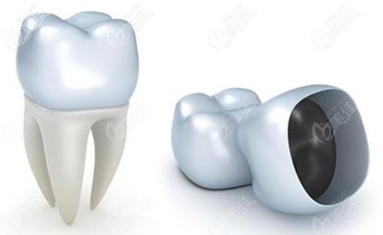 金永俊院長淺談前牙美學種植的必要 金永俊院長淺談前牙美學種植的必要