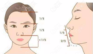 突嘴可能需要正頜手術(shù)改善 突嘴可能需要正頜手術(shù)改善