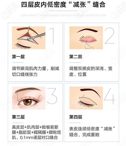 貝塞爾10°美眼綜合技術(shù)優(yōu)勢