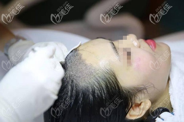 為防止原生發(fā)禿要及時(shí)做養(yǎng)護(hù)