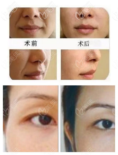 20200916_1600252112228320.jpg 3_副本.jpg